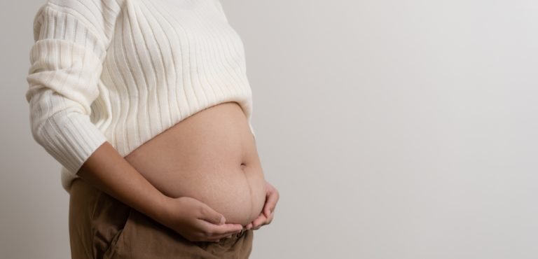 Cómo saber si es panza de embarazo o gordura obesidad