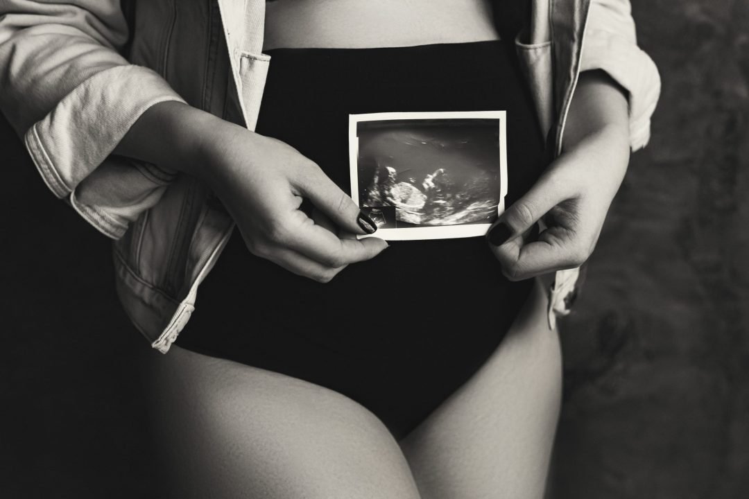 cómo saber si estas embarazada sin prueba de embarazo