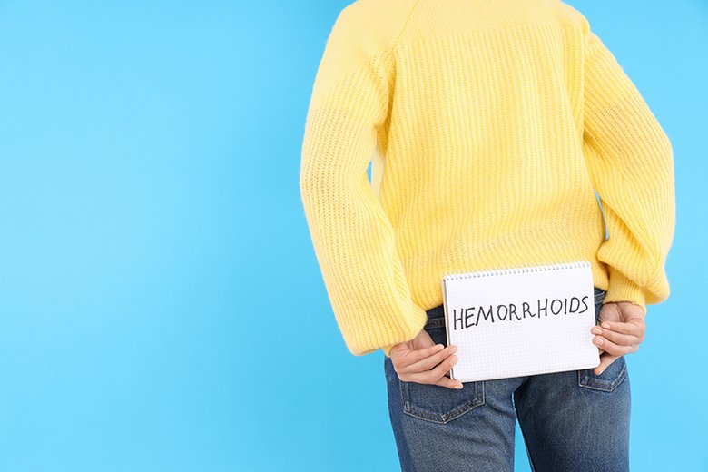 hemorroides externas